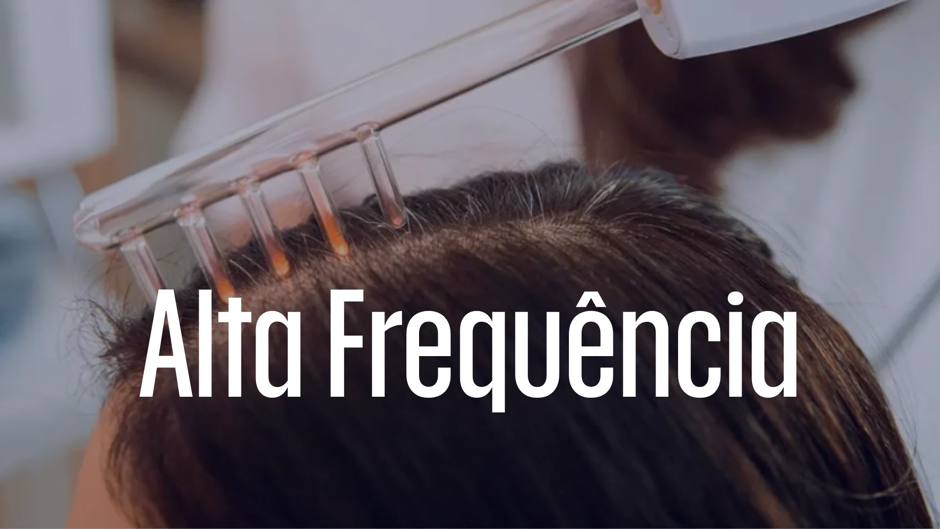 Alta Frequência — Protocolos nas Alterações Capilares