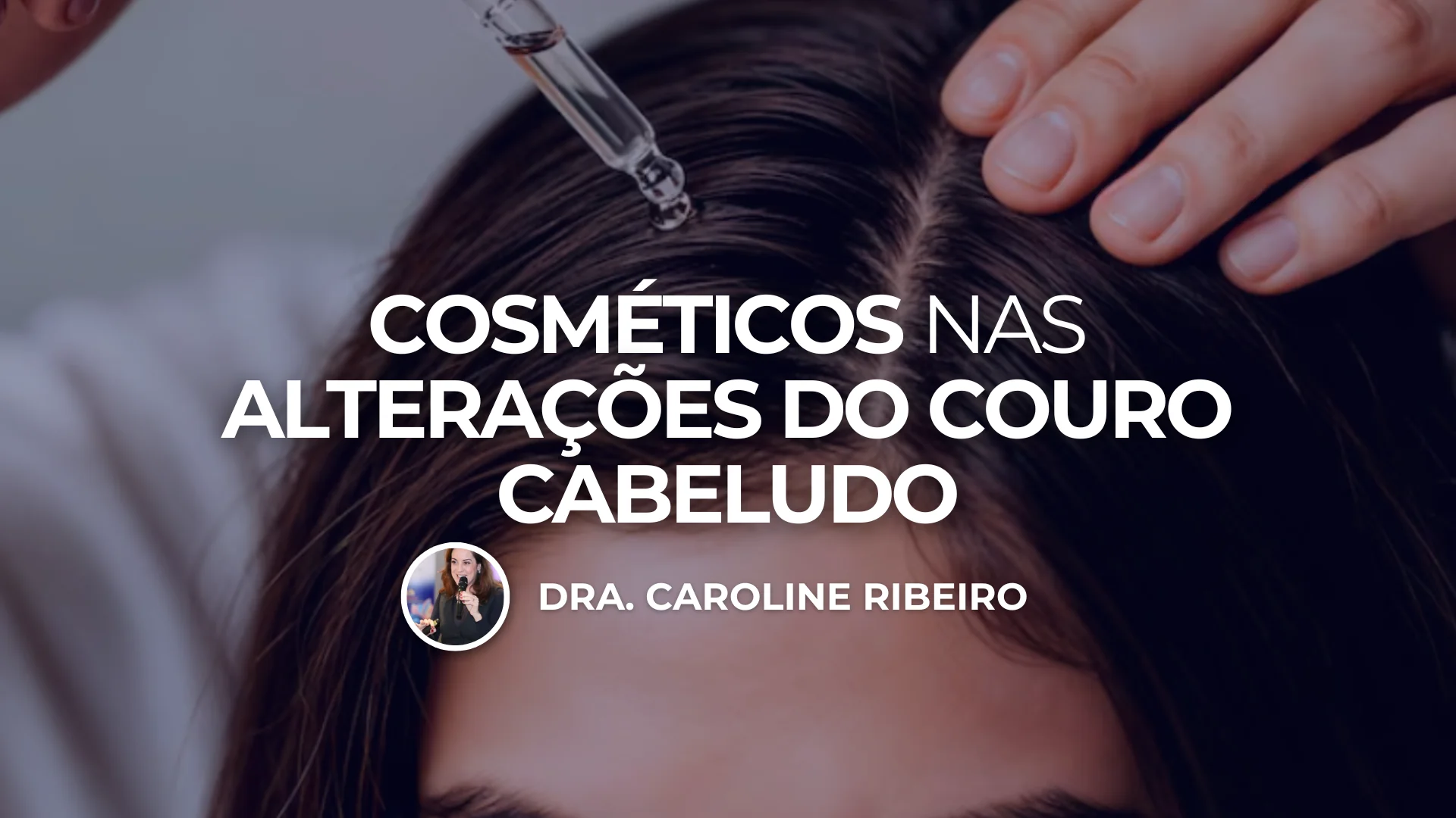 Cosméticos nas Alterações do Couro Cabeludo