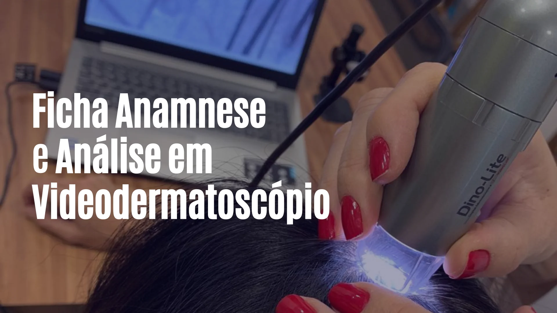 Ficha de Avaliação Capilar e Análise em Videodermatoscópio